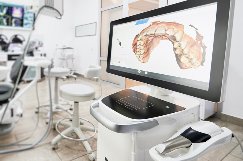 Intra-Oral Scanner in Fernley